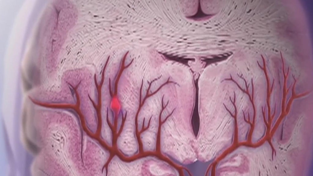 Knowing the signs of a stroke can save lives — Duluth Community news
